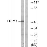 Rabbit Polyclonal Antibody to LRP11