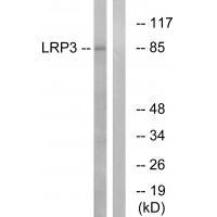 Rabbit Polyclonal Antibody to LRP3