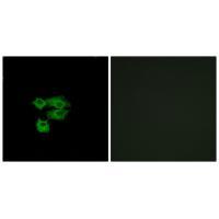 Rabbit Polyclonal Antibody to LY6E
