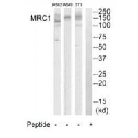 Rabbit Polyclonal Antibody to MRC1