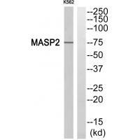 Rabbit Polyclonal Antibody to MASP2