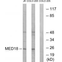 Rabbit Polyclonal Antibody to MED18