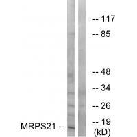 Rabbit Polyclonal Antibody to MRPS21