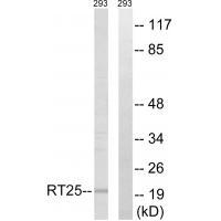 Rabbit Polyclonal Antibody to MRPS25