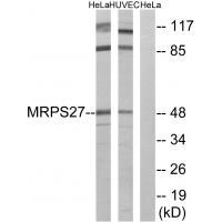 Rabbit Polyclonal Antibody to MRPS27