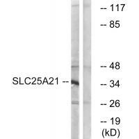 Rabbit Polyclonal Antibody to SLC25A21