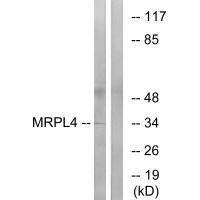 Rabbit Polyclonal Antibody to MRPL4