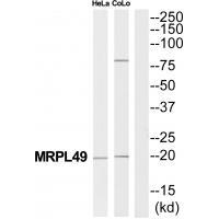 Rabbit Polyclonal Antibody to MRPL49