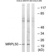 Rabbit Polyclonal Antibody to MRPL5