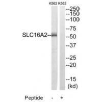 Rabbit Polyclonal Antibody to SLC16A2