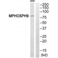 Rabbit Polyclonal Antibody to MPHOSPH9