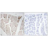 Rabbit Polyclonal Antibody to MYOM1