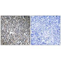 Rabbit Polyclonal Antibody to MPRIP