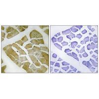 Rabbit Polyclonal Antibody to MYH4