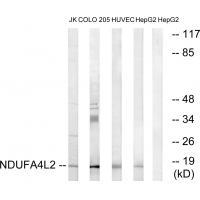Rabbit Polyclonal Antibody to NDUFA4L2