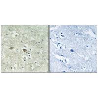 Rabbit Polyclonal Antibody to NDUFV3