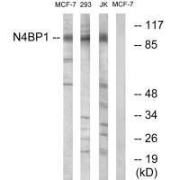 Rabbit Polyclonal Antibody to N4BP1