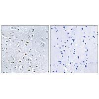 Rabbit Polyclonal Antibody to NPHP4