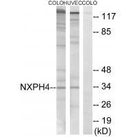 Rabbit Polyclonal Antibody to NXPH4