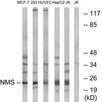 Rabbit Polyclonal Antibody to NMS