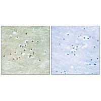 Rabbit Polyclonal Antibody to NPAS4