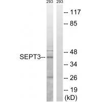 Rabbit Polyclonal Antibody to 45172