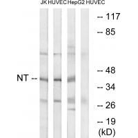 Rabbit Polyclonal Antibody to NT