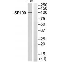 Rabbit Polyclonal Antibody to SP10
