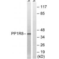 Rabbit Polyclonal Antibody to PPP1R8