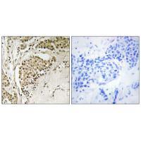Rabbit Polyclonal Antibody to NOM1
