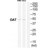 Rabbit Polyclonal Antibody to OAT