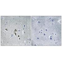 Rabbit Polyclonal Antibody to OAZ1