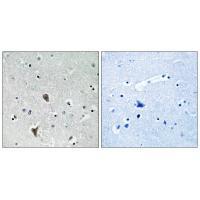 Rabbit Polyclonal Antibody to OXR1