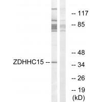 Rabbit Polyclonal Antibody to ZDHHC15