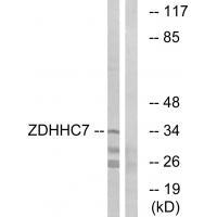 Rabbit Polyclonal Antibody to ZDHHC7