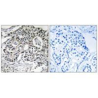 Rabbit Polyclonal Antibody to PXMP2