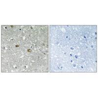 Rabbit Polyclonal Antibody to PIGH