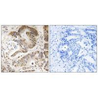Rabbit Polyclonal Antibody to PIK3R5