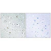 Rabbit Polyclonal Antibody to PLA1A