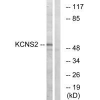 Rabbit Polyclonal Antibody to KCNS2