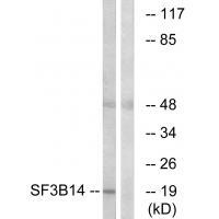 Rabbit Polyclonal Antibody to SF3B14