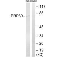 Rabbit Polyclonal Antibody to PRPF39