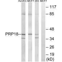 Rabbit Polyclonal Antibody to PRPF18