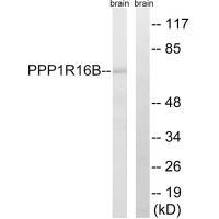 Rabbit Polyclonal Antibody to PPP1R16B