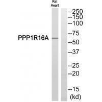 Rabbit Polyclonal Antibody to PPP1R16A