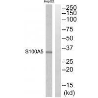 Rabbit Polyclonal Antibody to S100A5