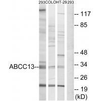 Rabbit Polyclonal Antibody to ABCC13
