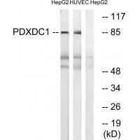 Rabbit Polyclonal Antibody to PDXDC1
