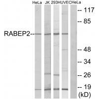 Rabbit Polyclonal Antibody to RABEP2