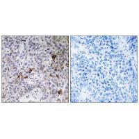 Rabbit Polyclonal Antibody to RAB11FIP3